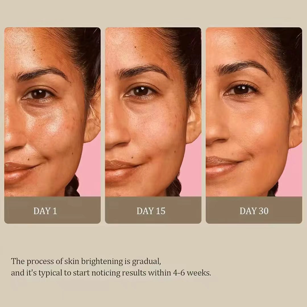 KURKUMA- & KOJIK-SEIFE - Entferner für dunkle Flecken, Akne-Entferner